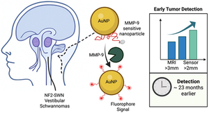 TOC image for article "Matrix Metalloproteinase-9 (MMP-9) Activatable Gold Nanoparticles for In Situ Zymography and Diagnostics of Neurofibromatosis Type 2 (NF2) Tumors". The image hyperlinks to the online publication.